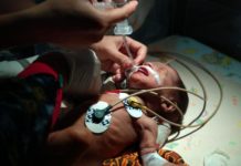 Bayi Berusia 45 Hari Butuh Biaya Pengobatan Rp100 Juta PENANGANAN MEDIS. Kondisi Fikri Haryadi yang dipasang alat bantu pernapasan mendapat pertolongan medis di Rumah Sakit ABK, Pontianak, Jumat (24/8). Rumah Zakat Kalbar for RK