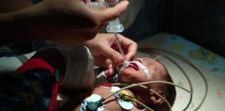 Bayi Berusia 45 Hari Butuh Biaya Pengobatan Rp100 Juta PENANGANAN MEDIS. Kondisi Fikri Haryadi yang dipasang alat bantu pernapasan mendapat pertolongan medis di Rumah Sakit ABK, Pontianak, Jumat (24/8). Rumah Zakat Kalbar for RK