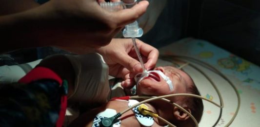 Bayi Berusia 45 Hari Butuh Biaya Pengobatan Rp100 Juta PENANGANAN MEDIS. Kondisi Fikri Haryadi yang dipasang alat bantu pernapasan mendapat pertolongan medis di Rumah Sakit ABK, Pontianak, Jumat (24/8). Rumah Zakat Kalbar for RK