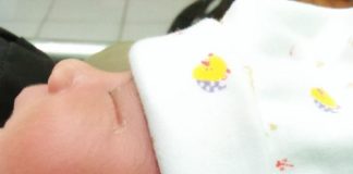 Abizard Lahir dengan Lekukan Telinga Menyerupai Lafadz Allah