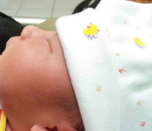 Abizard Lahir dengan Lekukan Telinga Menyerupai Lafadz Allah