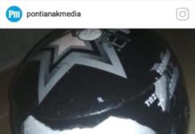 Warga Mengaku Kena Timpa Triplek