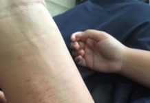 Pengen Viral Jadi Motif Gores Tangan