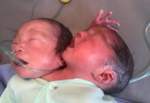 Hanya Ada Satu Kelahiran dalam Dua Ratus Ribu