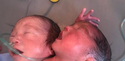 Hanya Ada Satu Kelahiran dalam Dua Ratus Ribu