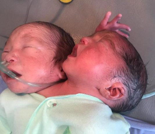 Hanya Ada Satu Kelahiran dalam Dua Ratus Ribu