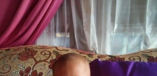 Bocah Kelainan Jantung Tak Punya Biaya