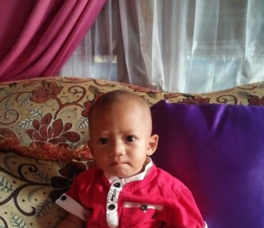 Bocah Kelainan Jantung Tak Punya Biaya