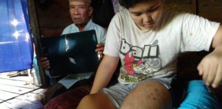 I-Jari ‘Boyong’ Siti Aminah ke RS Antonius