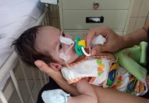 Awalnya Sulit Menyusu, Butuh Biaya Operasi Rp150 Juta