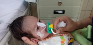 Awalnya Sulit Menyusu, Butuh Biaya Operasi Rp150 Juta