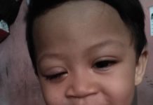 Tak Ada Dana Operasi Mata, Zakiarta Butuh Bantuan