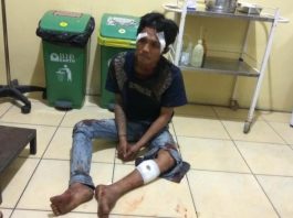 Melawan Polisi, Residivis Curanmor Dibuat Pincang