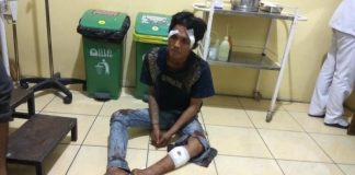 Melawan Polisi, Residivis Curanmor Dibuat Pincang