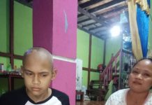 Tumor di Saraf Mata, Ilham Roji Butuh Dermawan