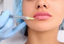 Efek Melakukan Suntik Filler Berulang