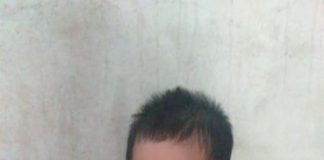 Tak Punya Biaya, Penderita Tumor Jalani Pengobatan Kampung