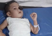 Zakiarta Jalani Pemeriksaan Sampel Cairan Sumsum dan Otak