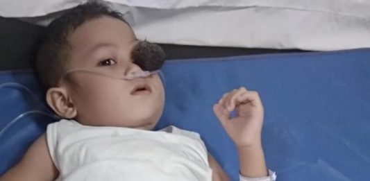 Zakiarta Jalani Pemeriksaan Sampel Cairan Sumsum dan Otak