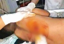 Pelajar SMP Ditusuk Pembegal