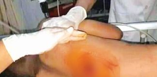 Pelajar SMP Ditusuk Pembegal