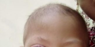 Zaki Akan Jalani Proses Kemoterapi Tahap Dua