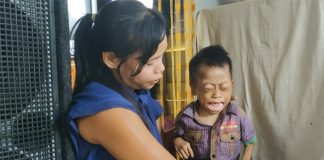 Diawali Kejang-kejang, Nutrisi ke Otak Ariansyah pun Terganggu