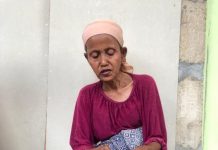 Demi Rupiah, Tori Kerja Kupas Bawang Sampai Sakit