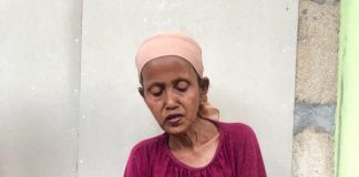 Demi Rupiah, Tori Kerja Kupas Bawang Sampai Sakit