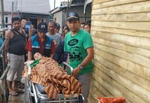 Dua Bulan Terkulai di Rumah Tanpa Pengobatan, Anjani Akhirnya Dilarikan ke Puskesmas