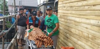 Dua Bulan Terkulai di Rumah Tanpa Pengobatan, Anjani Akhirnya Dilarikan ke Puskesmas