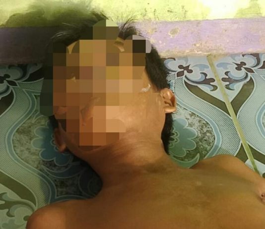 Warga Temukan Mayat tanpa Busana Tergeletak di Teras Rumah